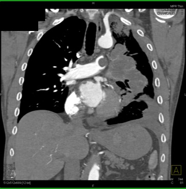 CTisus Quiz