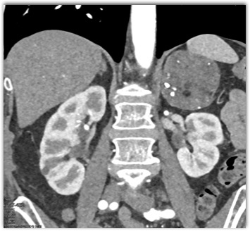 CTisus Quiz
