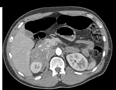 CTisus Quiz
