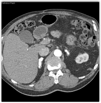 CTisus Quiz
