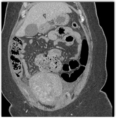 CTisus Quiz