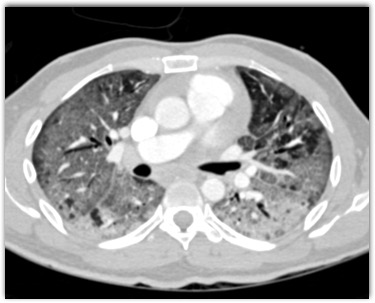 CTisus Quiz
