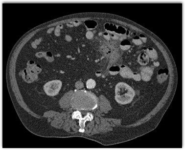 CTisus Quiz