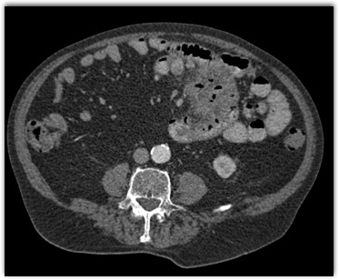 CTisus Quiz