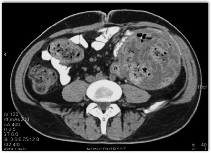 CTisus Quiz