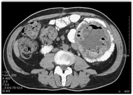 CTisus Quiz