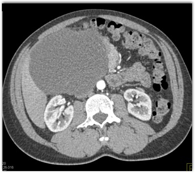 CTisus Quiz