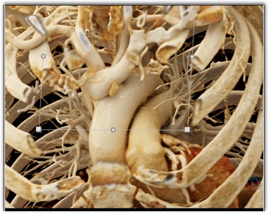 CTisus Quiz