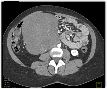 CTisus Quiz