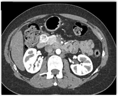 CTisus Quiz