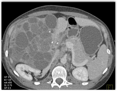 CTisus Quiz