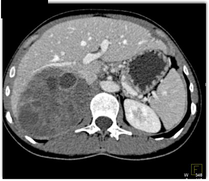 CTisus Quiz