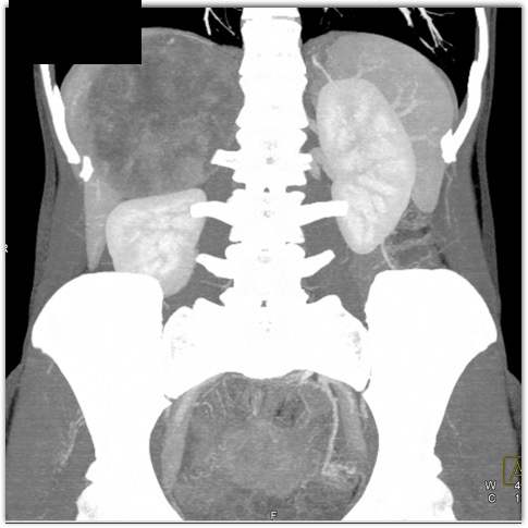 CTisus Quiz