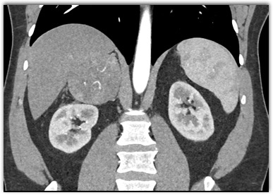 CTisus Quiz
