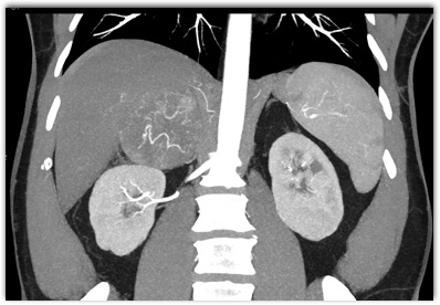 CTisus Quiz