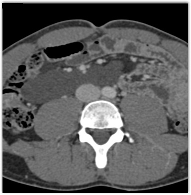 CTisus Quiz