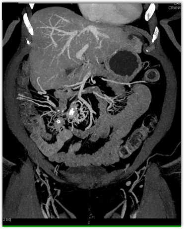 CTisus Quiz