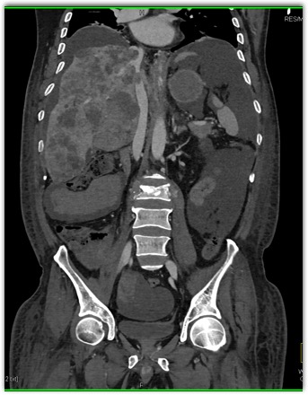 CTisus Quiz