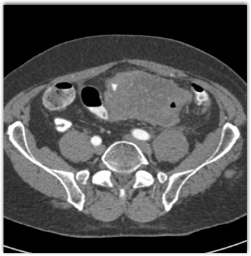 CTisus Quiz
