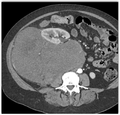 CTisus Quiz