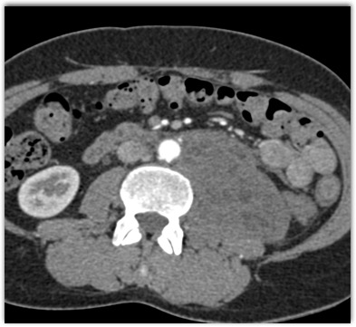 CTisus Quiz