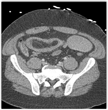 CTisus Quiz