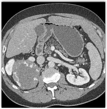 CTisus Quiz
