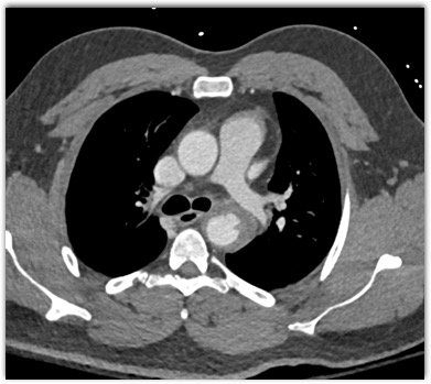 CTisus Quiz