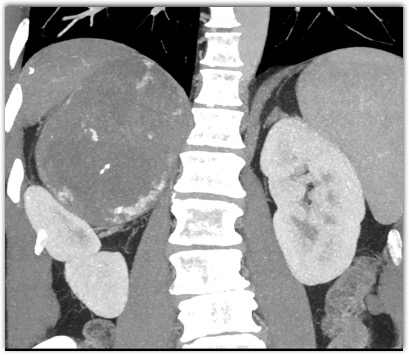 CTisus Quiz