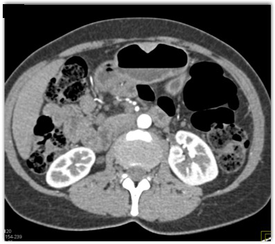 CTisus Quiz
