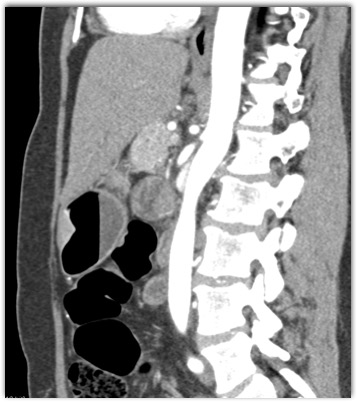 CTisus Quiz