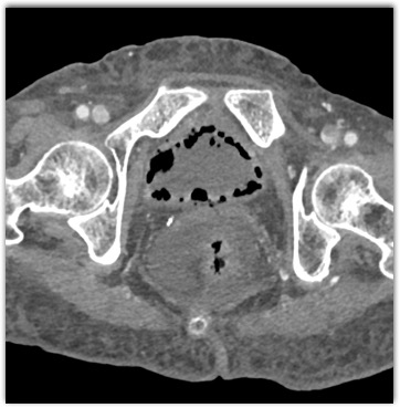 CTisus Quiz
