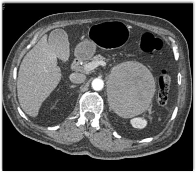 CTisus Quiz