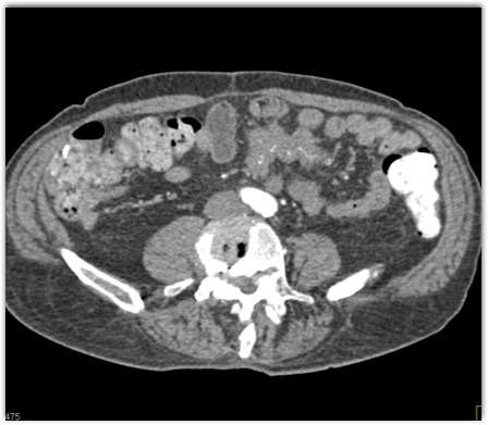 CTisus Quiz