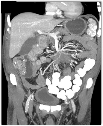 CTisus Quiz