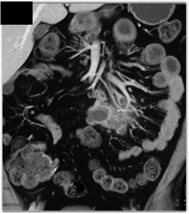 CTisus Quiz