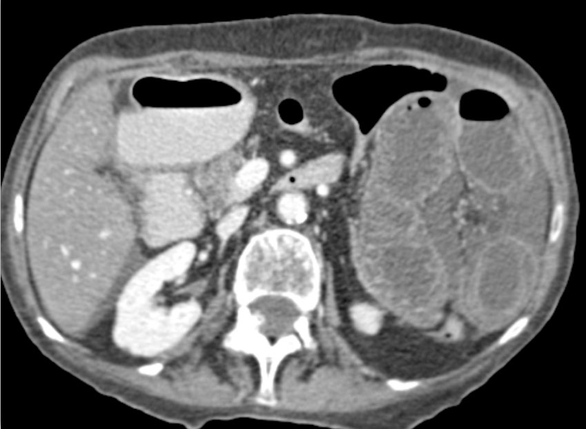 CTisus Quiz
