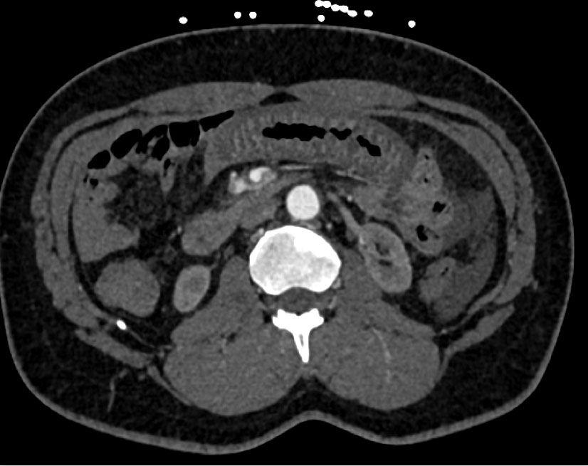 CTisus Quiz
