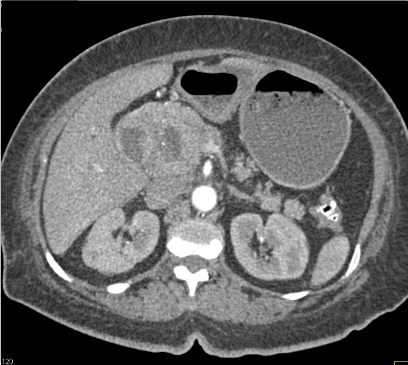 CTisus Quiz