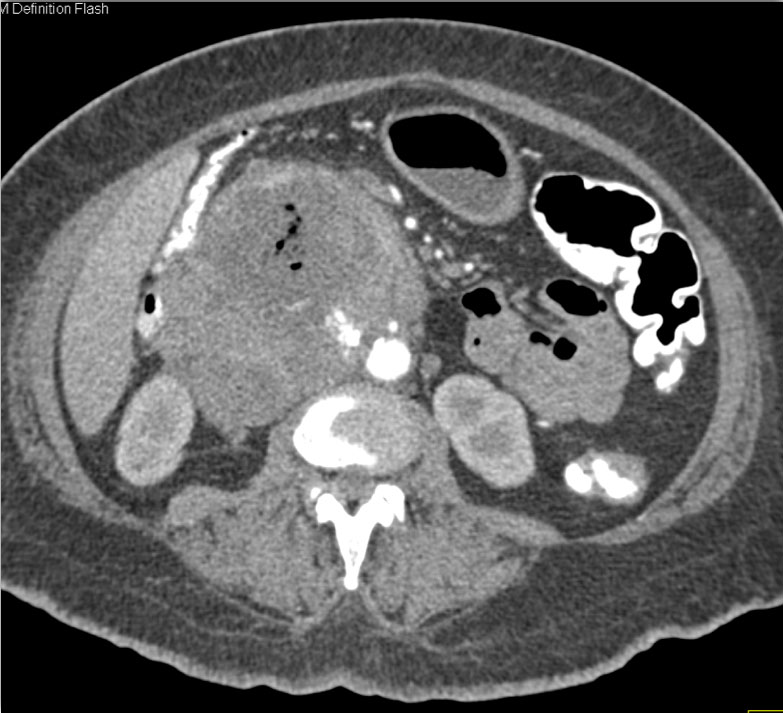 CTisus Quiz