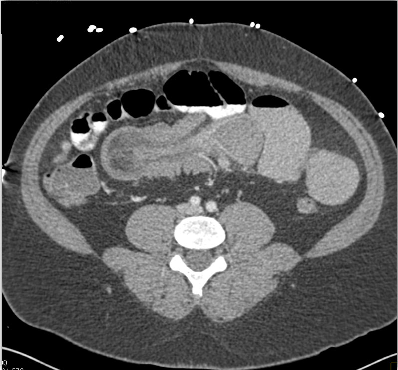 CTisus Quiz