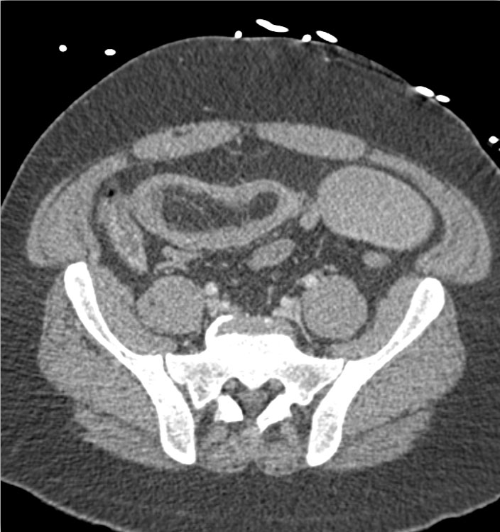 CTisus Quiz