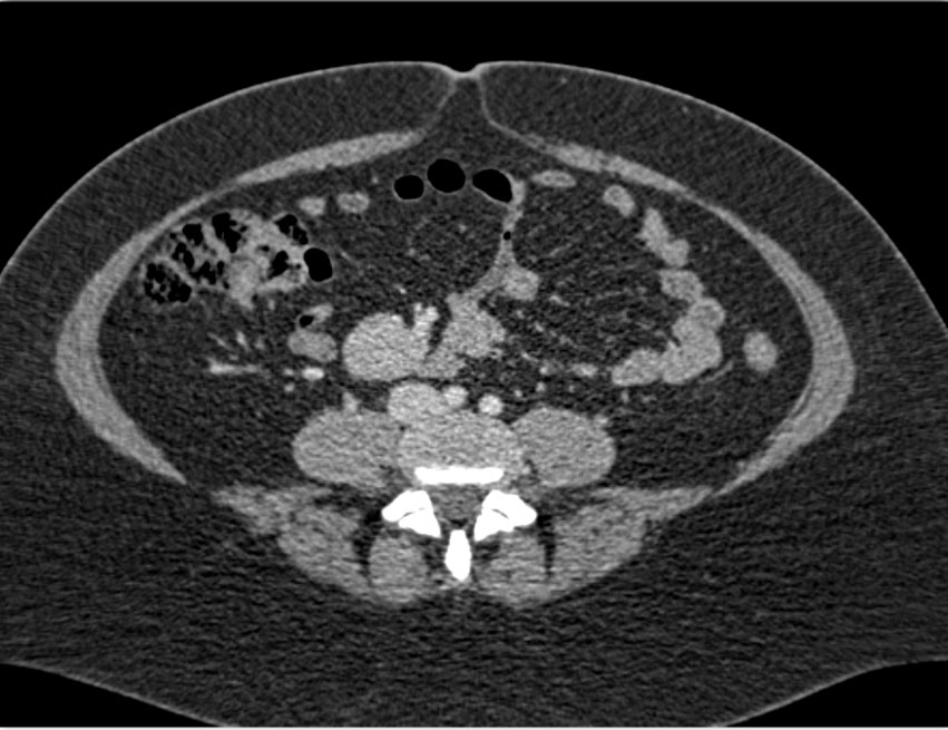 CTisus Quiz