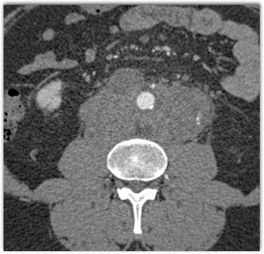 CTisus Quiz