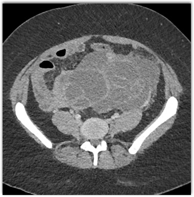CTisus Quiz