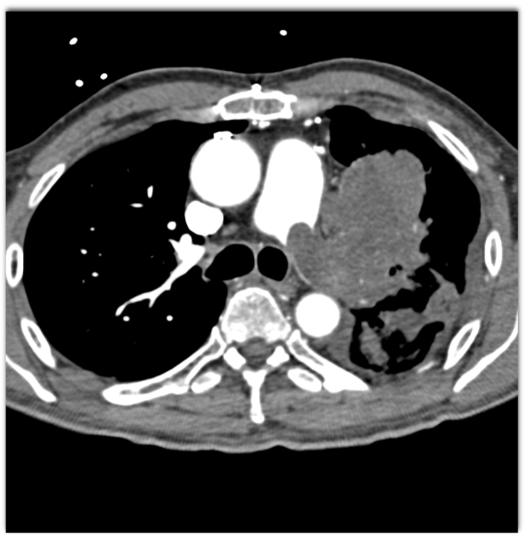 CTisus Quiz