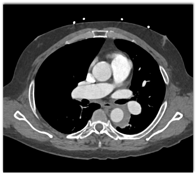 CTisus Quiz