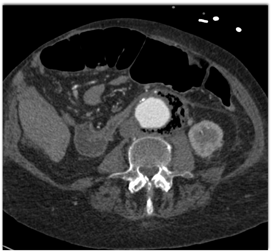 CTisus Quiz