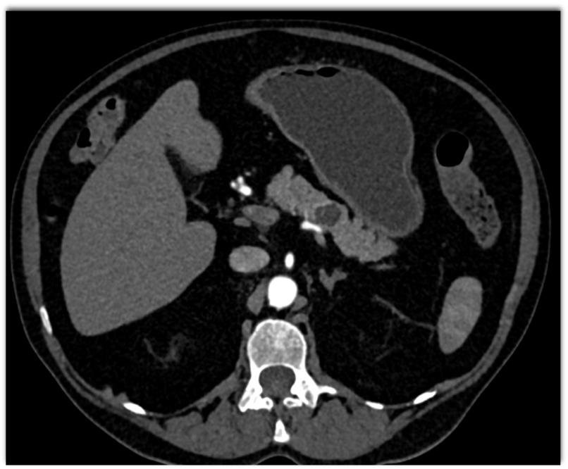 CTisus Quiz