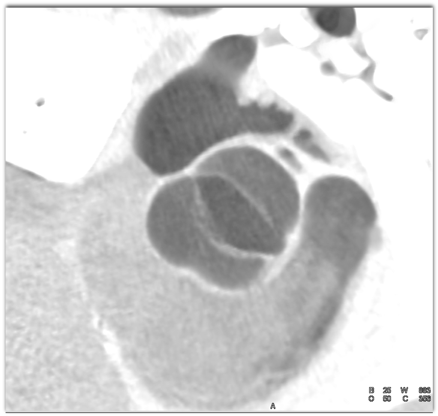 CTisus Quiz
